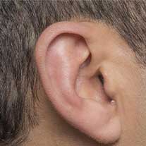 Invisible In-the-Canal (IIC) Hearing Aid Styles